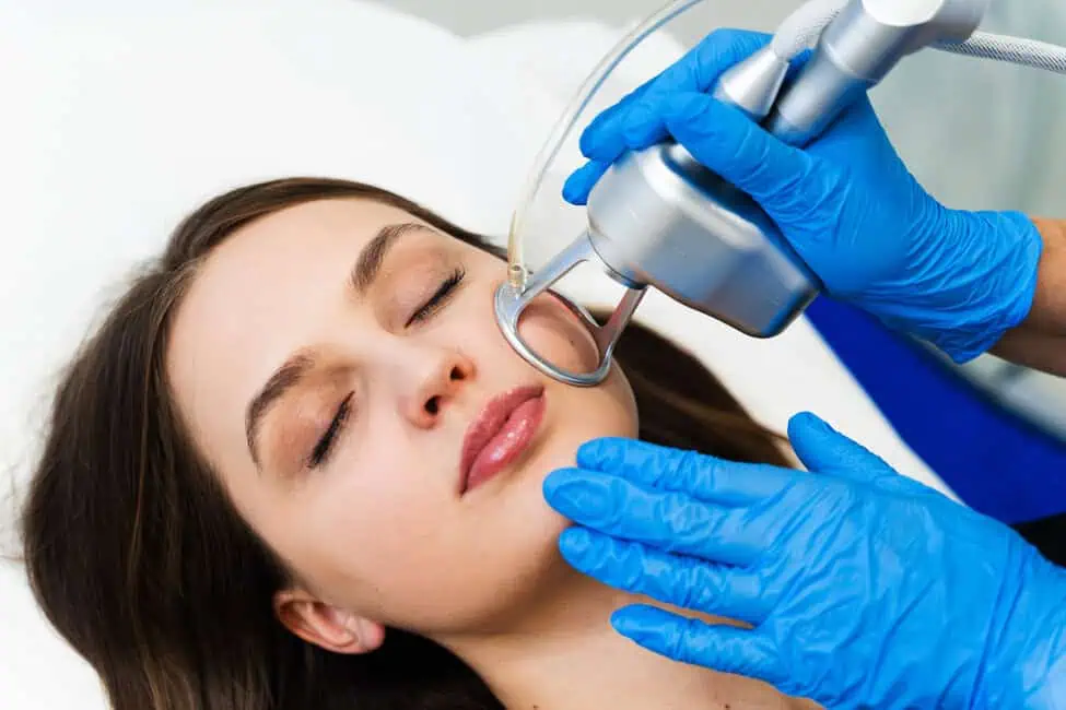 Tetra CO2 Laser by Vita Aesthetics in Sarasota, FL
