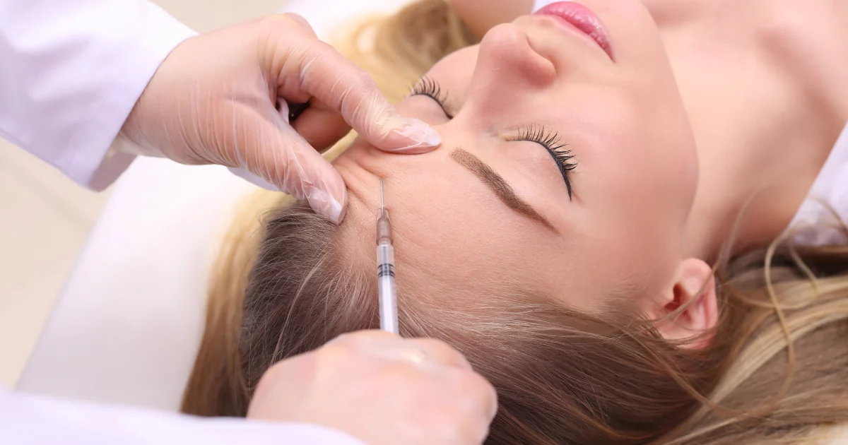 How Sculptra Smooths Deep Wrinkles and Facial Folds