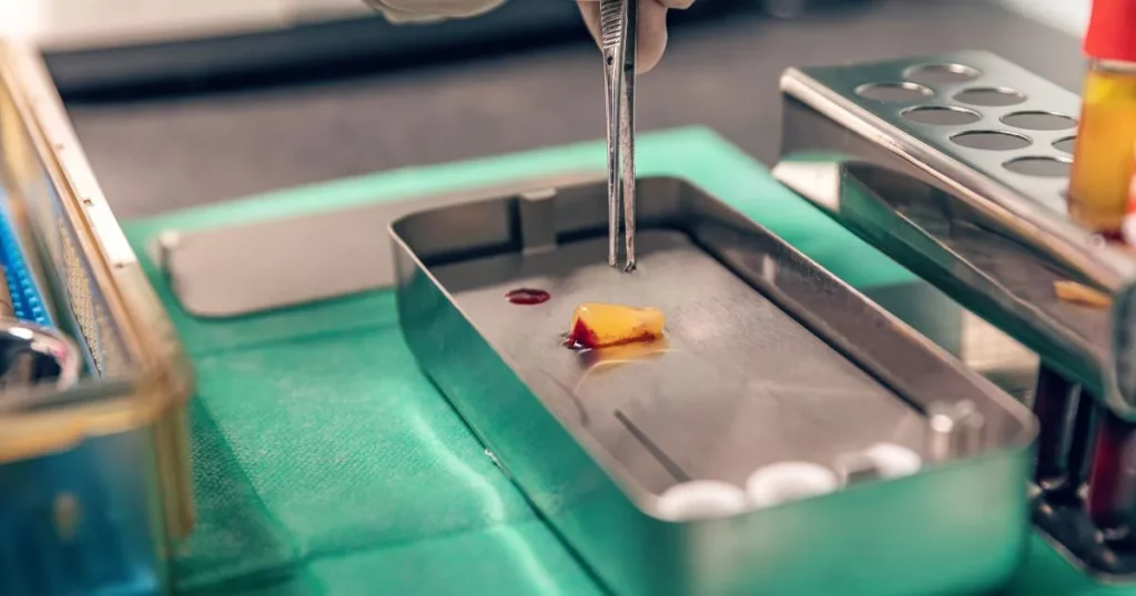 Top 5 Reasons to Choose PRF for Non-Surgical Skin Rejuvenation