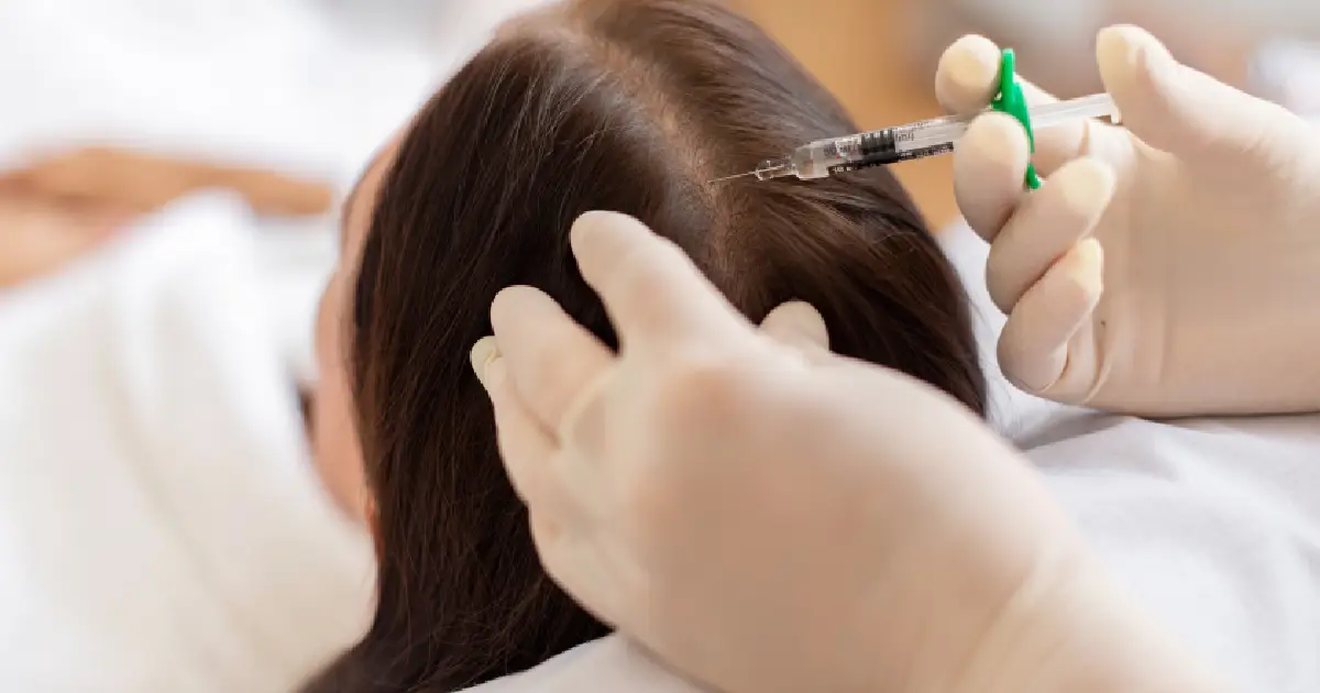 Is PRF Hair Treatment Right for Your Hair Loss Concerns?